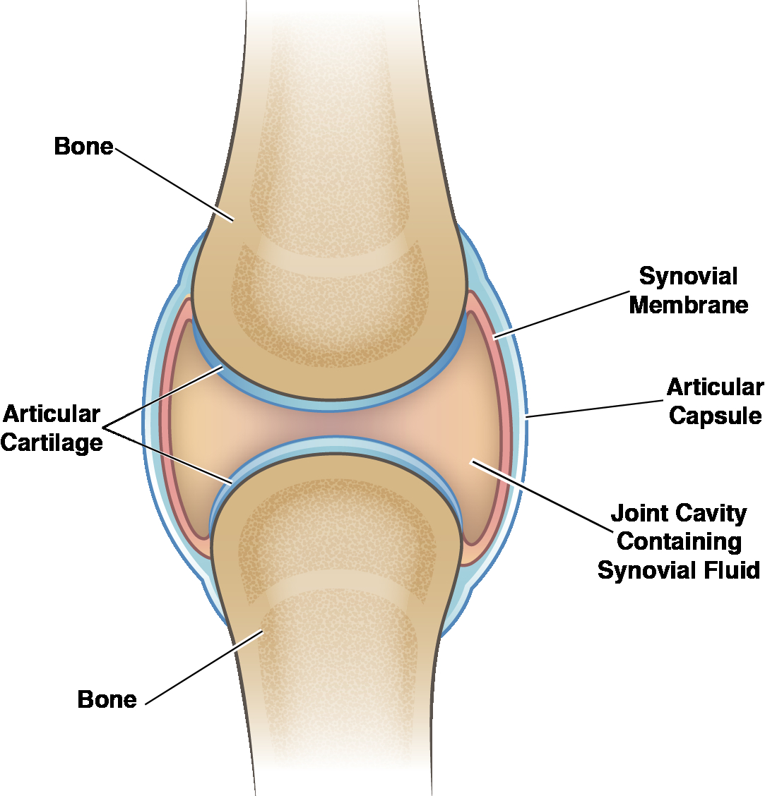 Diagram Of The Knee Guide To Severe Knee Arthritis Osteoarthritis Spring Loaded