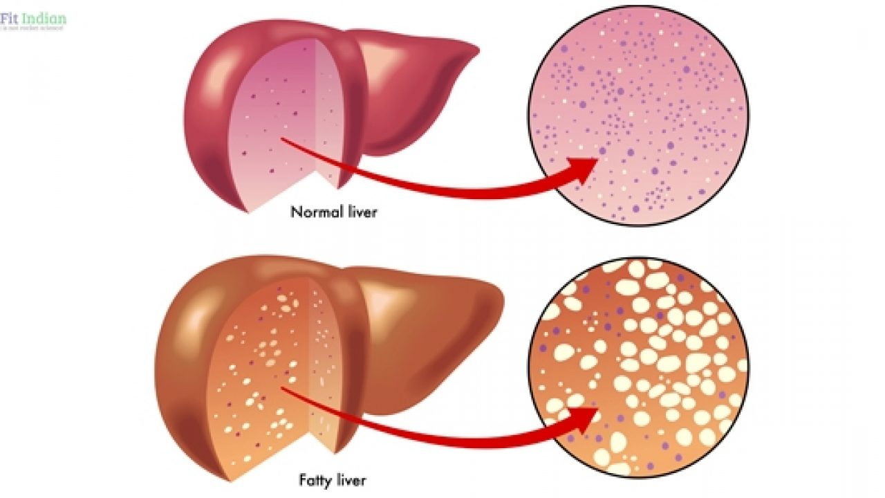 Diagram Of The Liver 14 Natural Home Remedies For Liver Disease With 6 Potent Juices