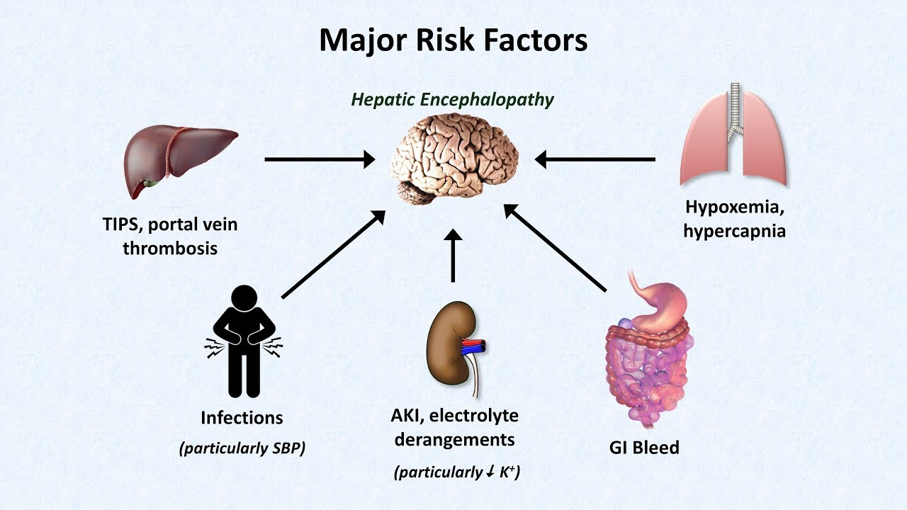 Diagram Of The Liver Hepatic Encephalopathy