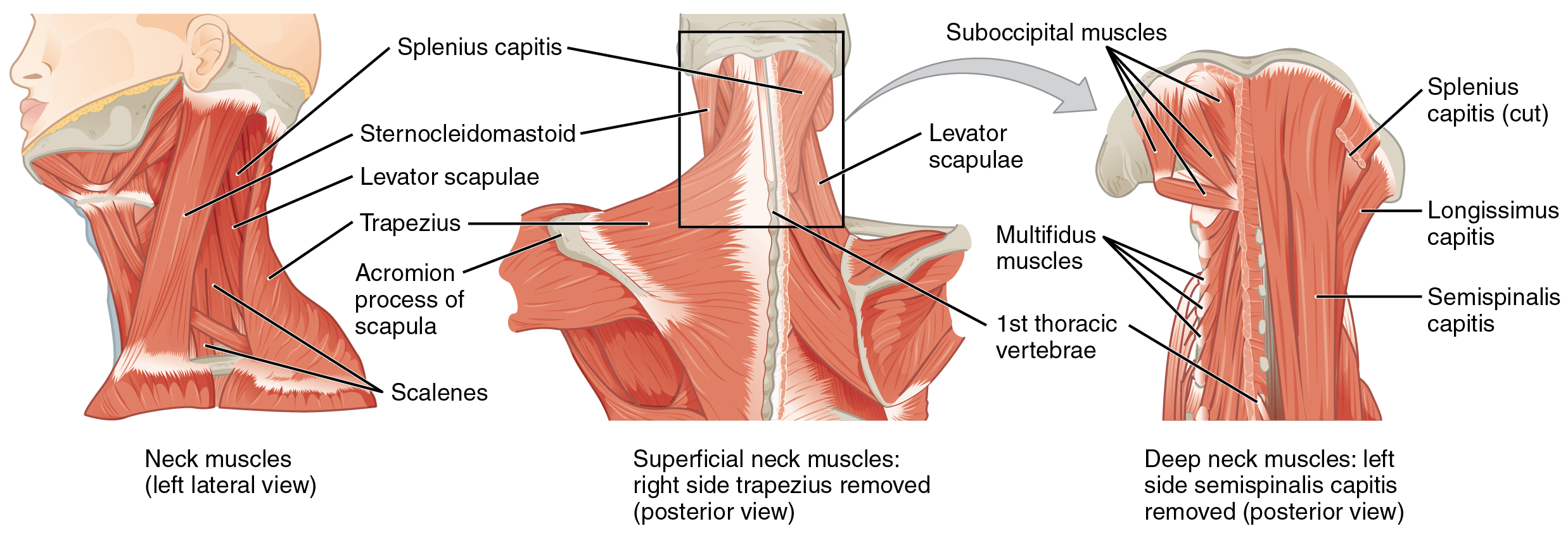 Back Muscles Diagram 113 Axial Muscles Of The Head Neck And Back Anatomy And Physiology