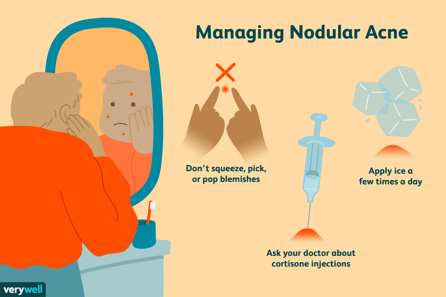 Blind Pimple Diagram Causes Of Nodular Acne And How To Treat It
