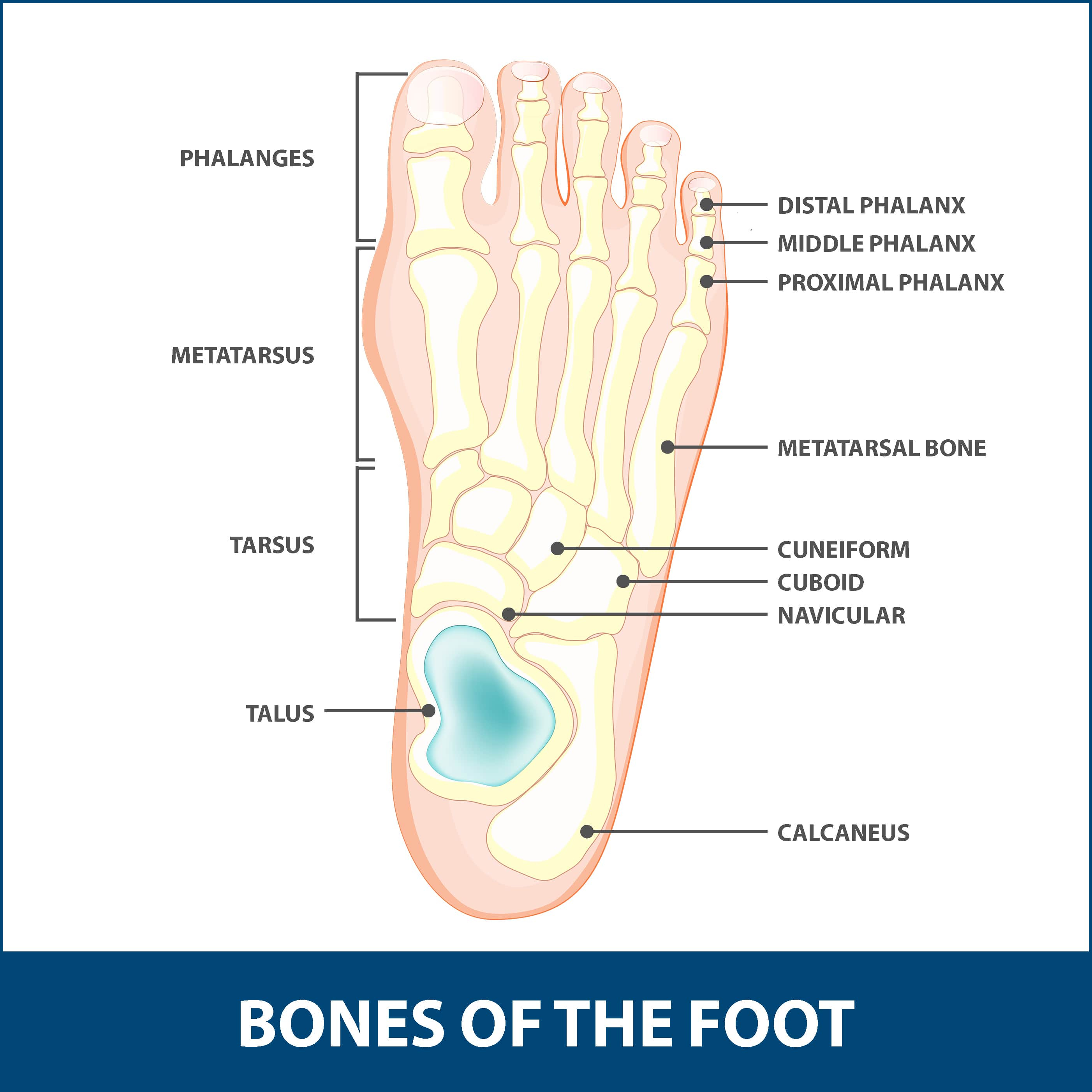 Diagram Of Foot Hallux Rigidus Cheilectomy Florida Orthopaedic Institute