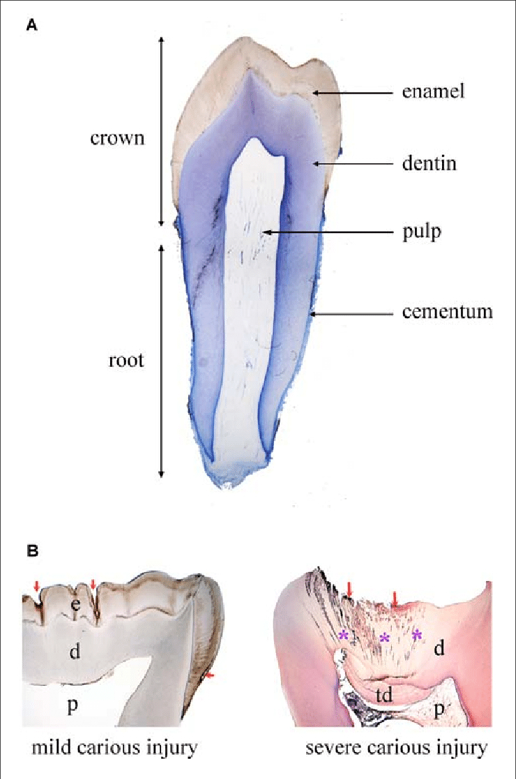 Diagram Of Teeth Tooth Structure In Physiological And Pathological Conditions A