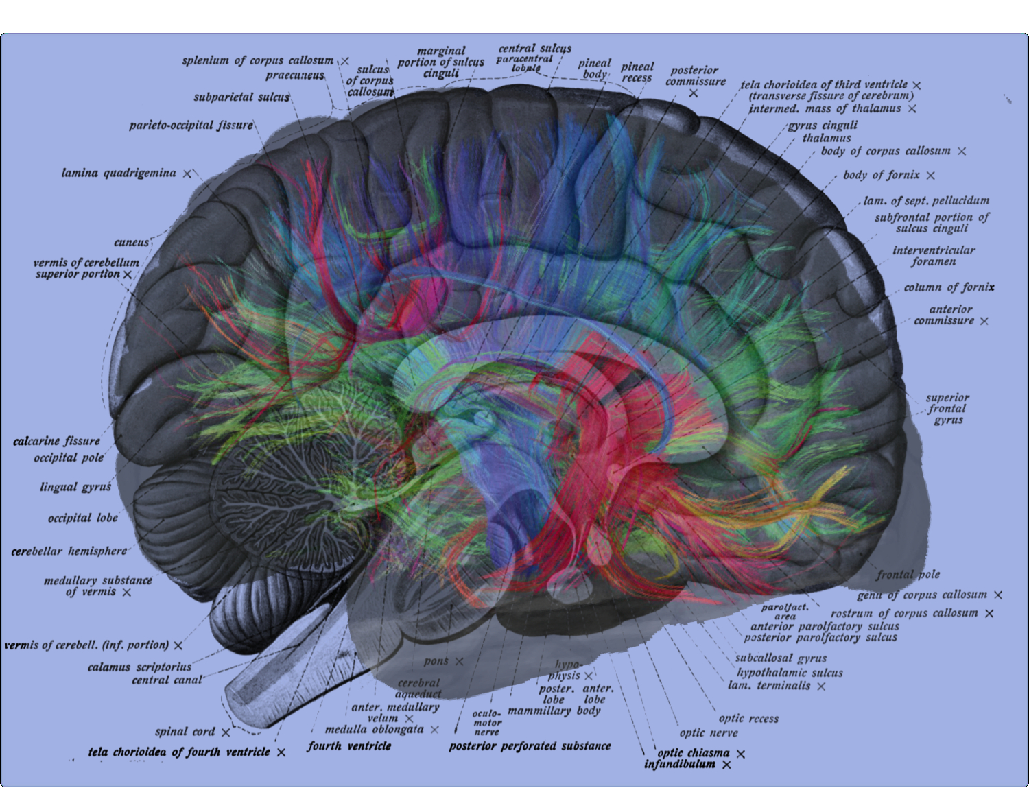 Diagram Of The Brain Mri Neural Brain Map Overlay On Human Brain Label Diagram Jacob Irwin