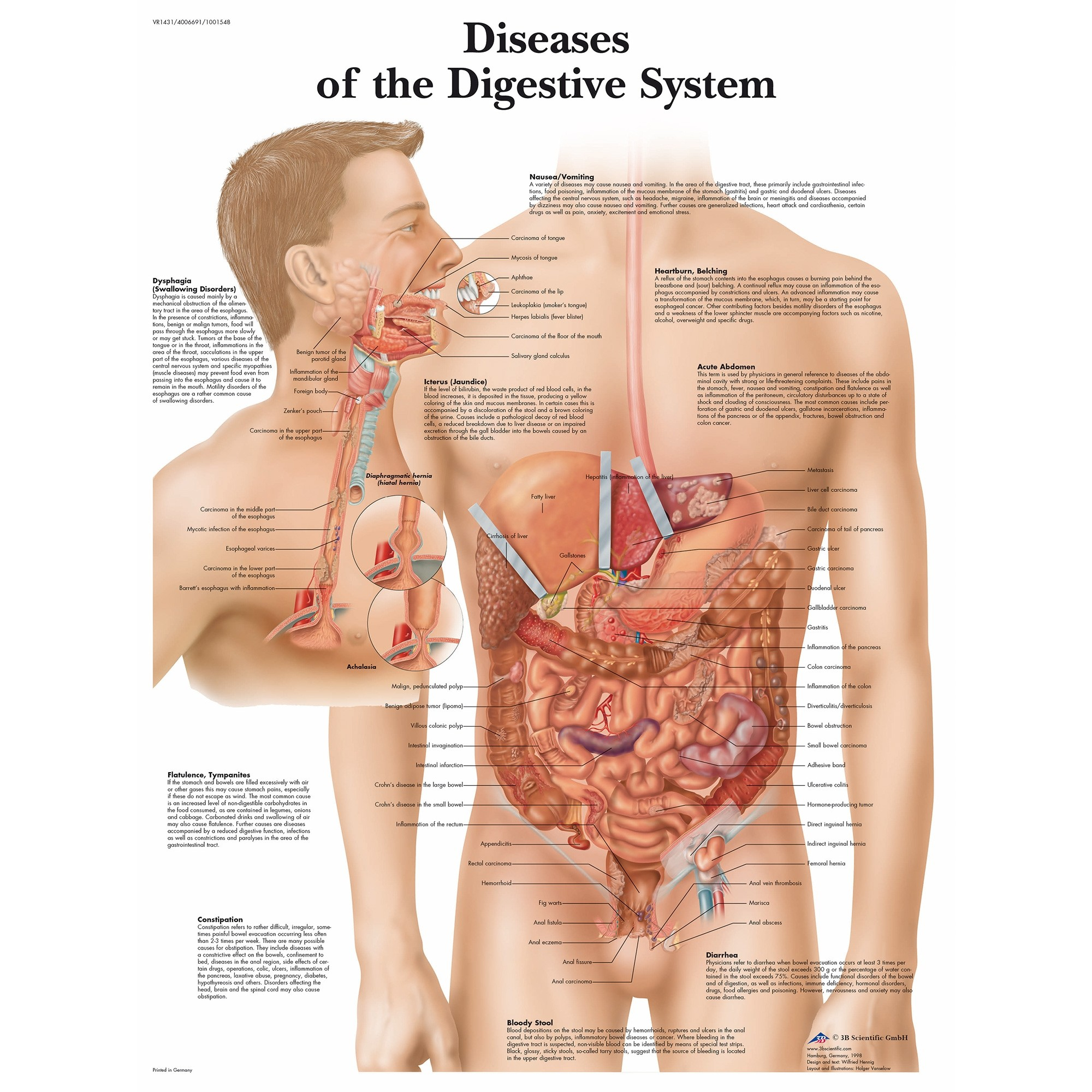 Diagram Of The Digestive System Diseases Digestive System Chart
