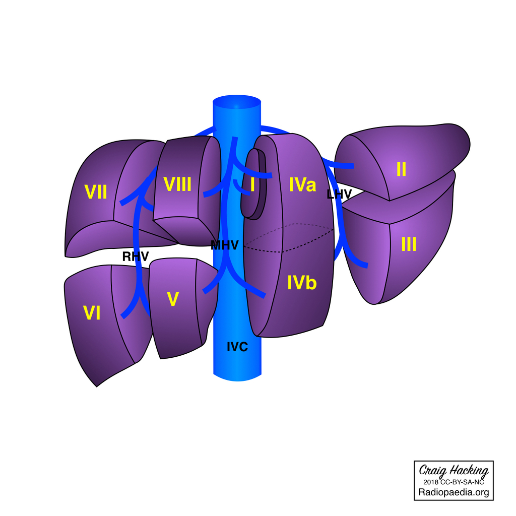 Diagram Of The Liver Couinaud Liver Segments And Sections Diagram Radiology Case