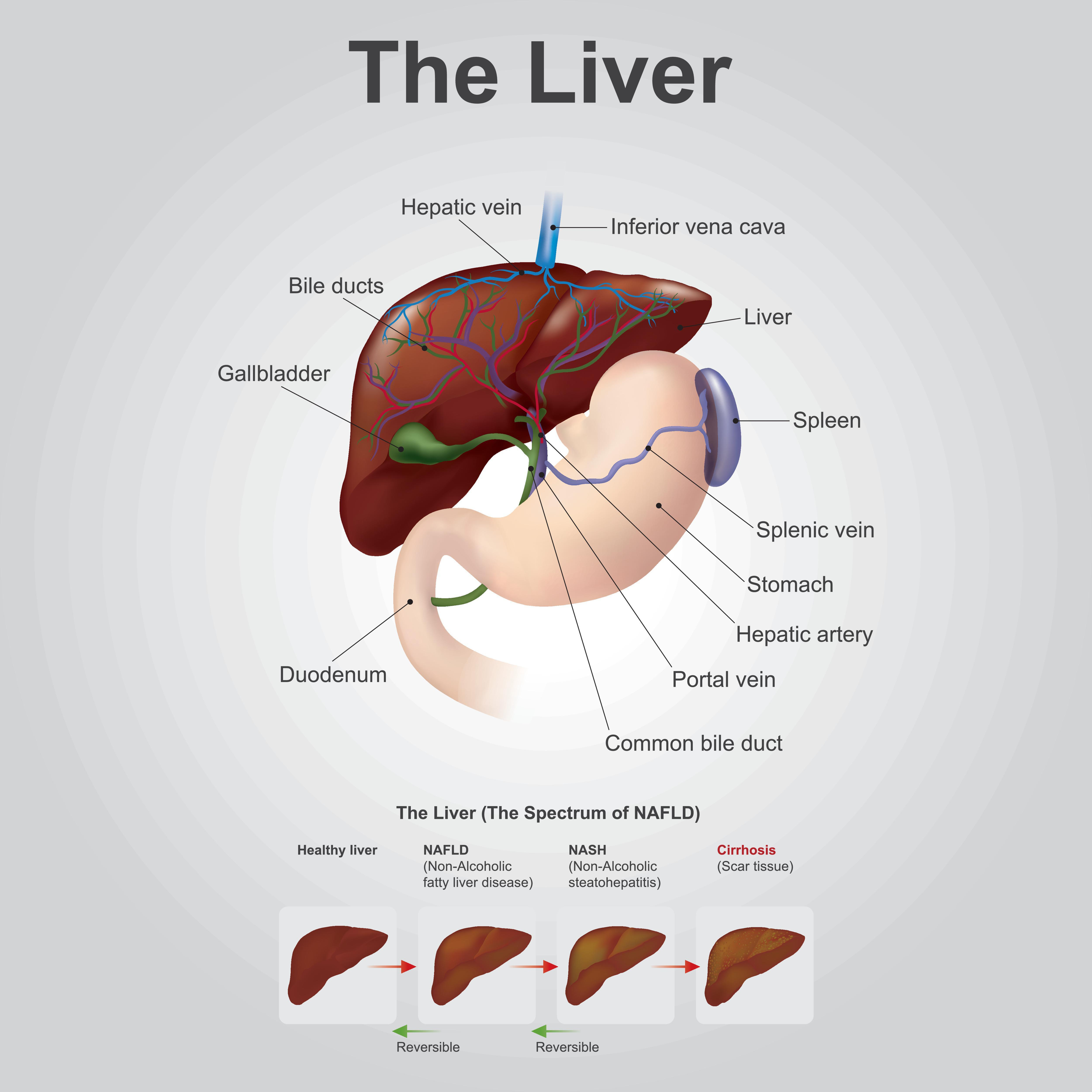 Diagram Of The Liver What Is Cirrhosis Of The Liver What Are The Symptoms What Is Life