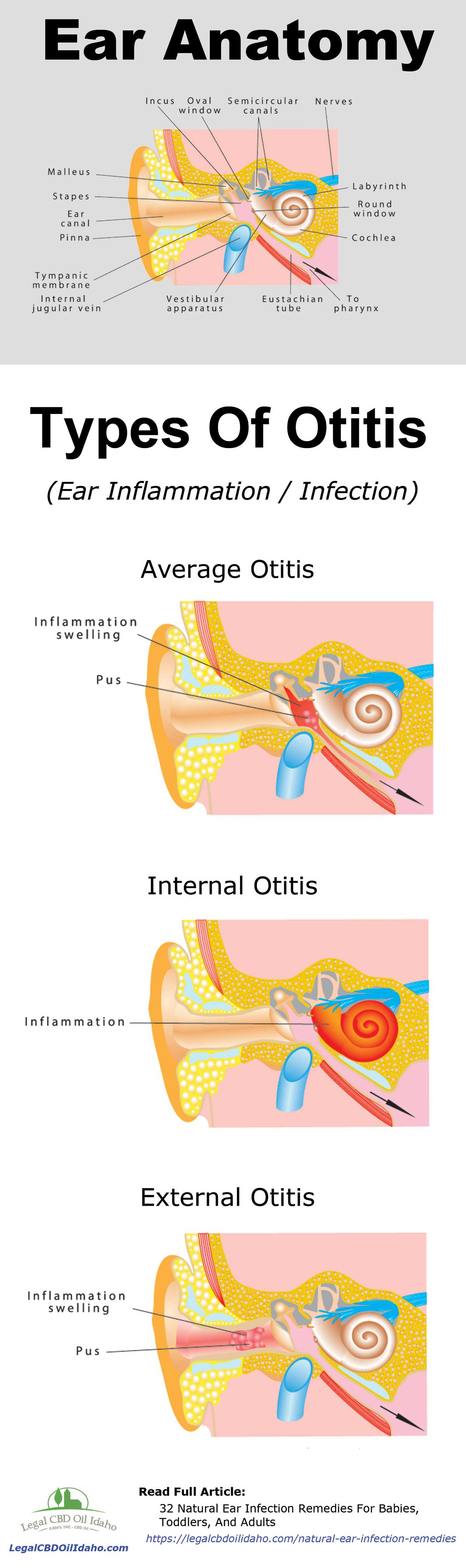 Ear Infection Diagram 32 Natural Ear Infection Remedies For Babies Toddlers And Adults