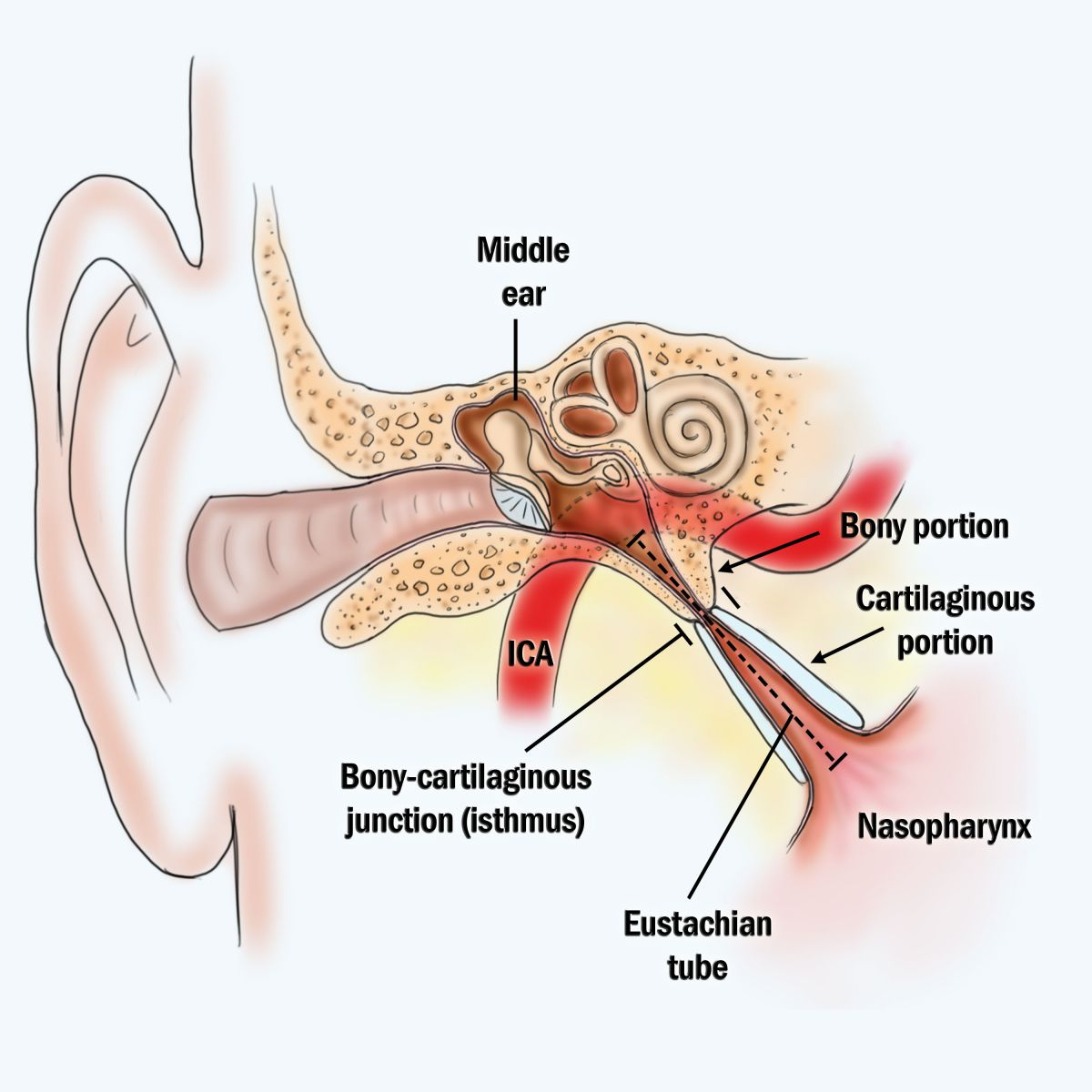 Ear Infection Diagram Hearing Loss The Head And Neck Center Pc