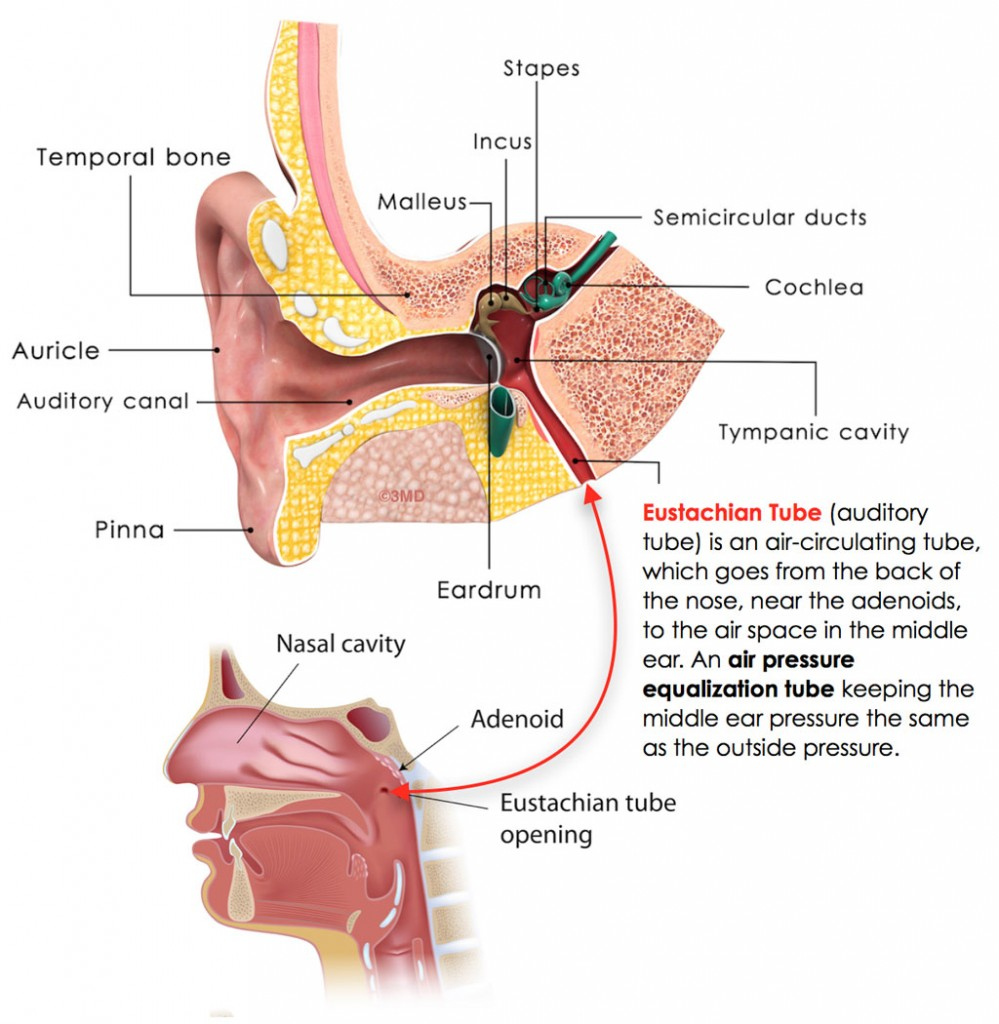 Ear Infection Diagram Middle Ear Infection Chronic Otitis Media In Children
