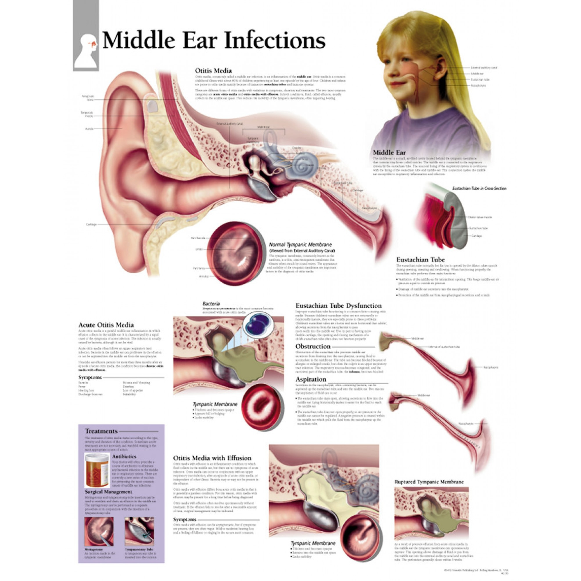 Ear Infection Diagram Middle Ear Infections Chart