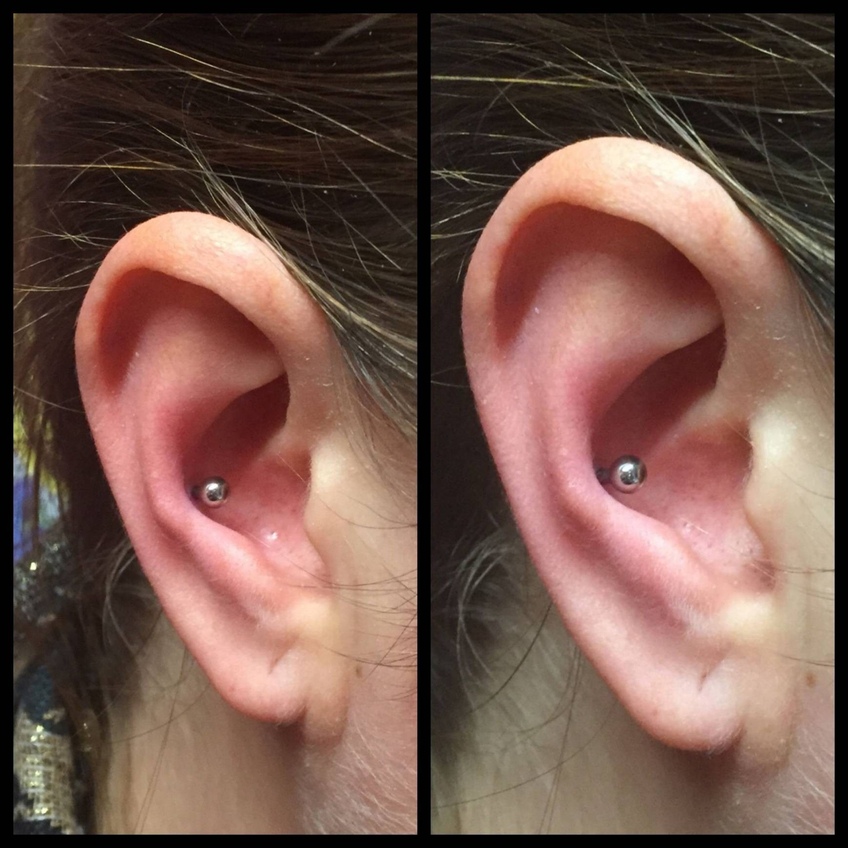 Ear Piercing Diagram Tragus Ear Piercing Infection Schn Ohrpiercing Helix Schmuck Frisch