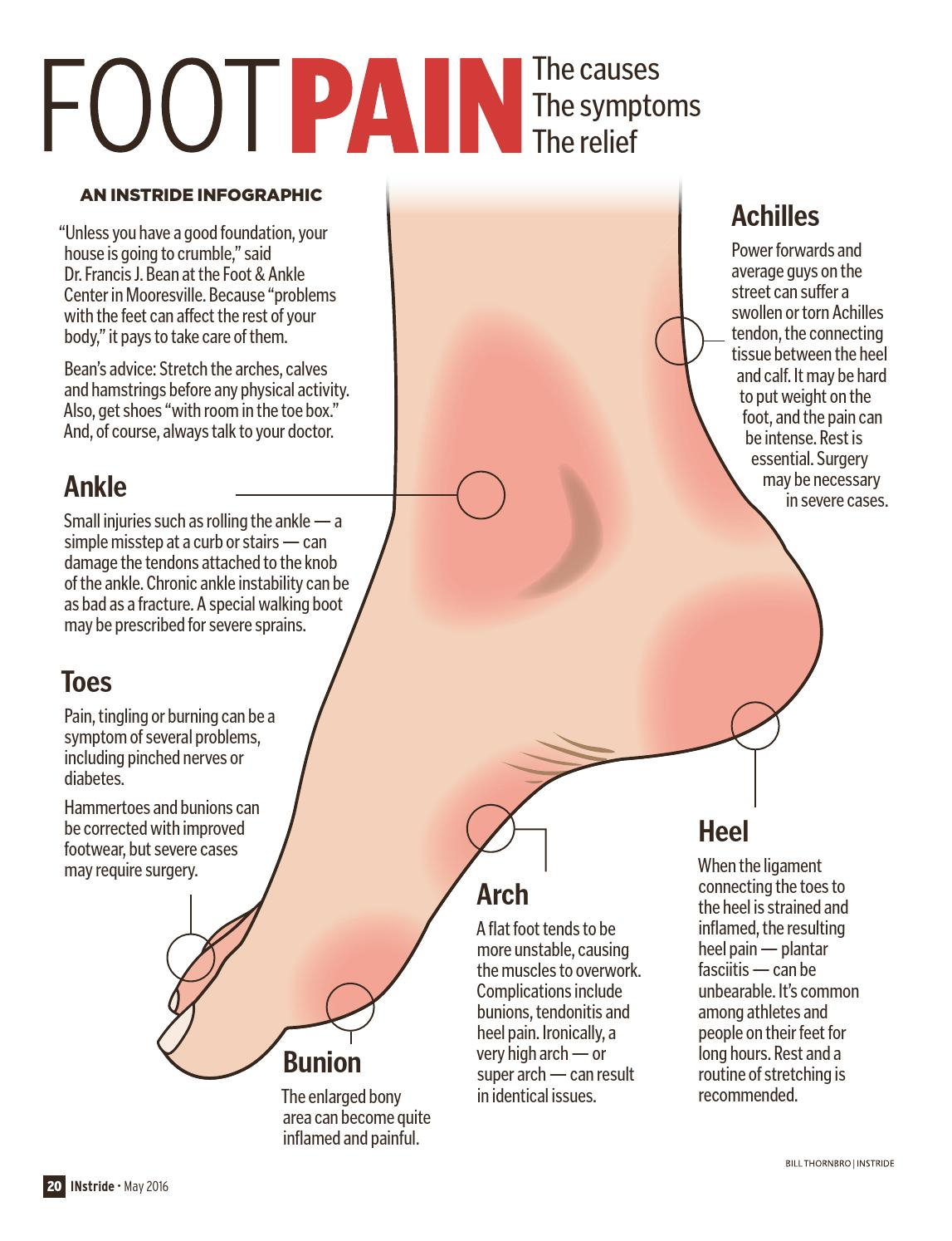 Foot Pain Diagram High Arches Feet Hurts When Walking