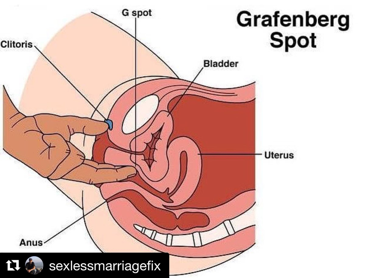 G Spot Diagram Sexlessmarriage Hashtag On Twitter
