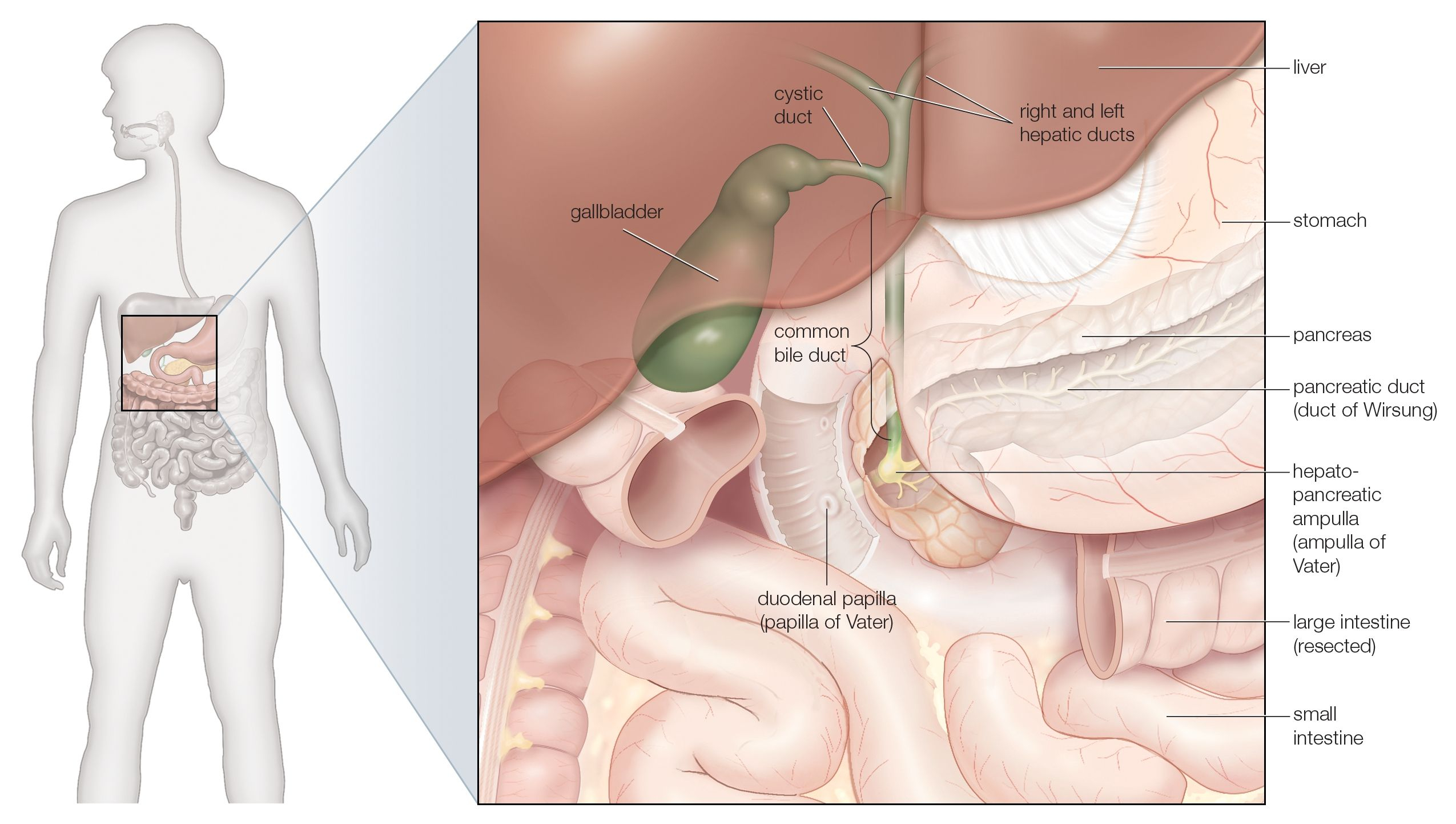 Gallbladder Pain Location Diagram Acute Cholangitis Symptoms And Treatment