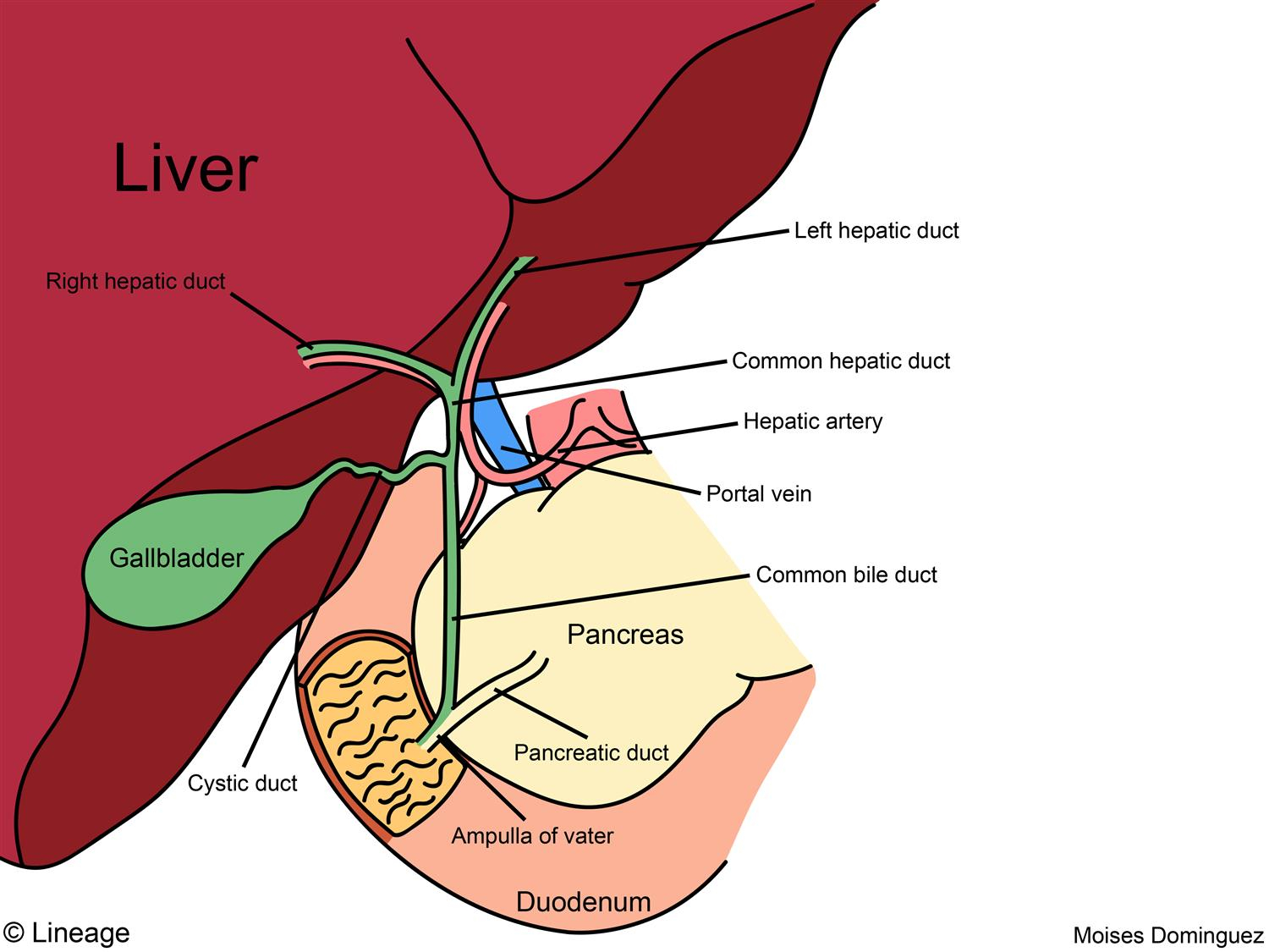 Gallbladder Pain Location Diagram Cholelithiasis And Biliary Colic Gastrointestinal Medbullets