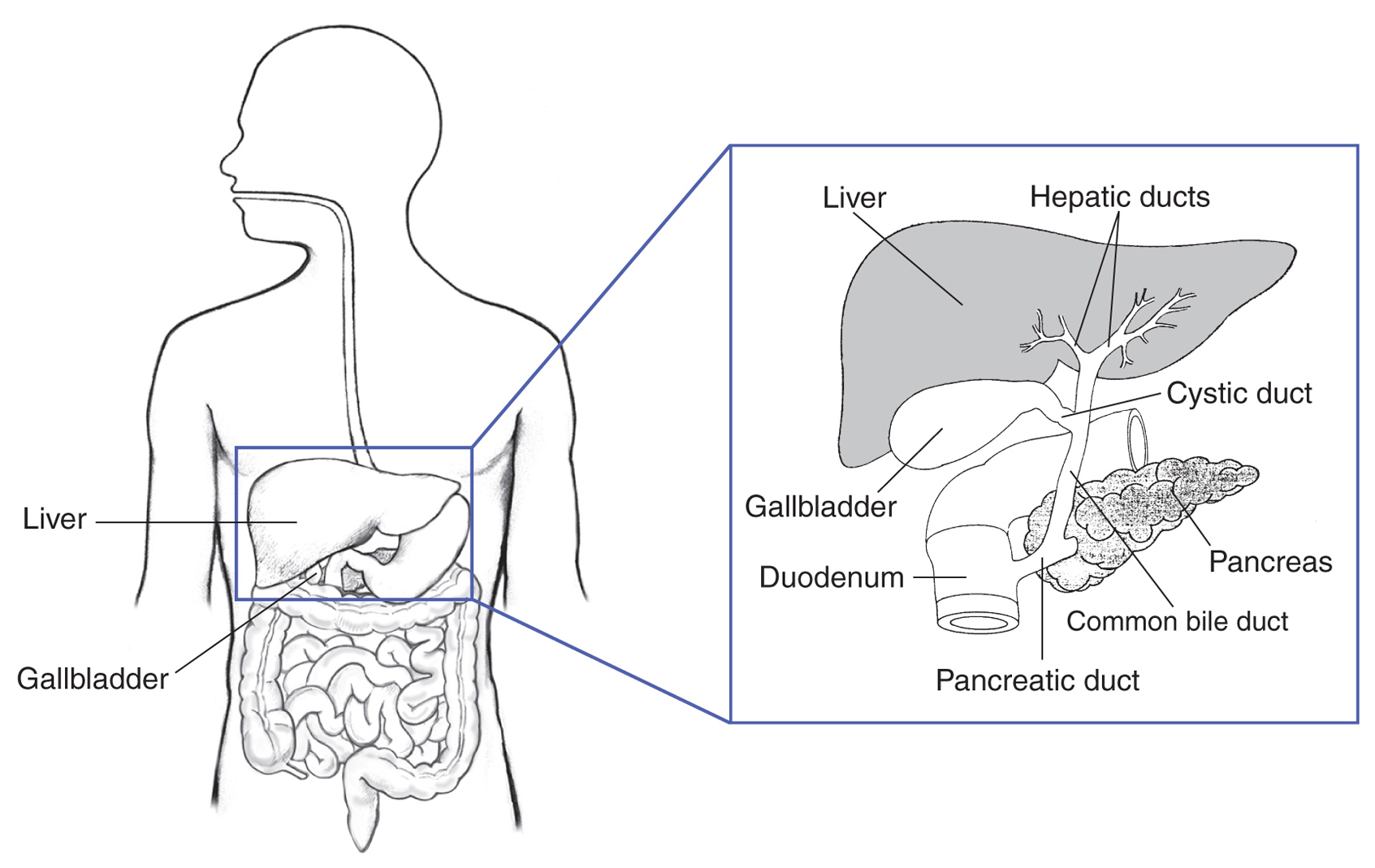 Gallbladder Pain Location Diagram Gallstones And Gallbladder Disease Lab Tests Online