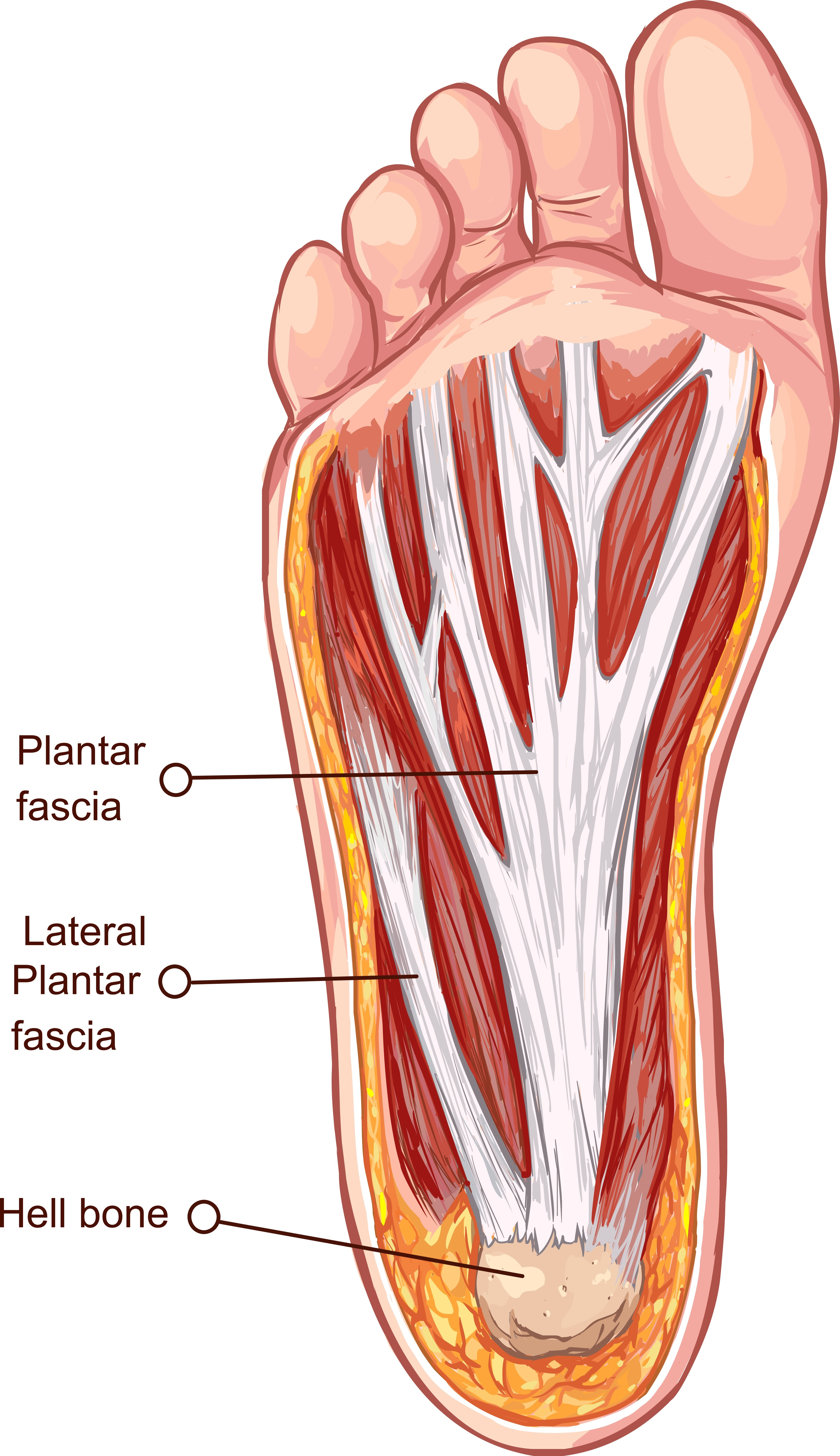 Plantar Fasciitis Diagram Heel Pain Footwork