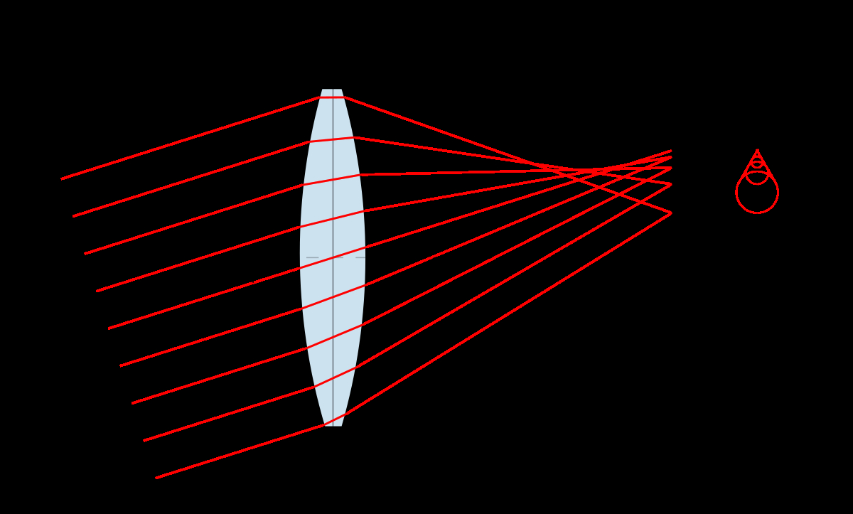 Ray Diagram Definition Coma Optics Wikipedia
