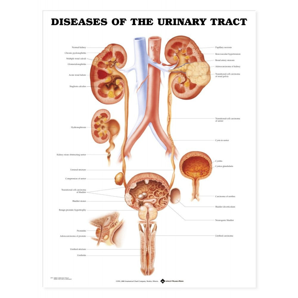 Urinary System Diagram Diseases Of The Urinary Tract Chart Poster Laminated