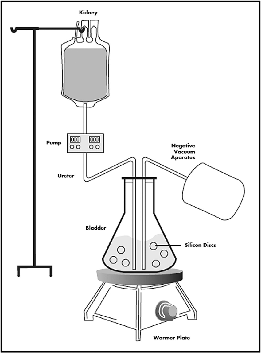 Urinary System Diagram In Vitro Urinary System Model Download Scientific Diagram