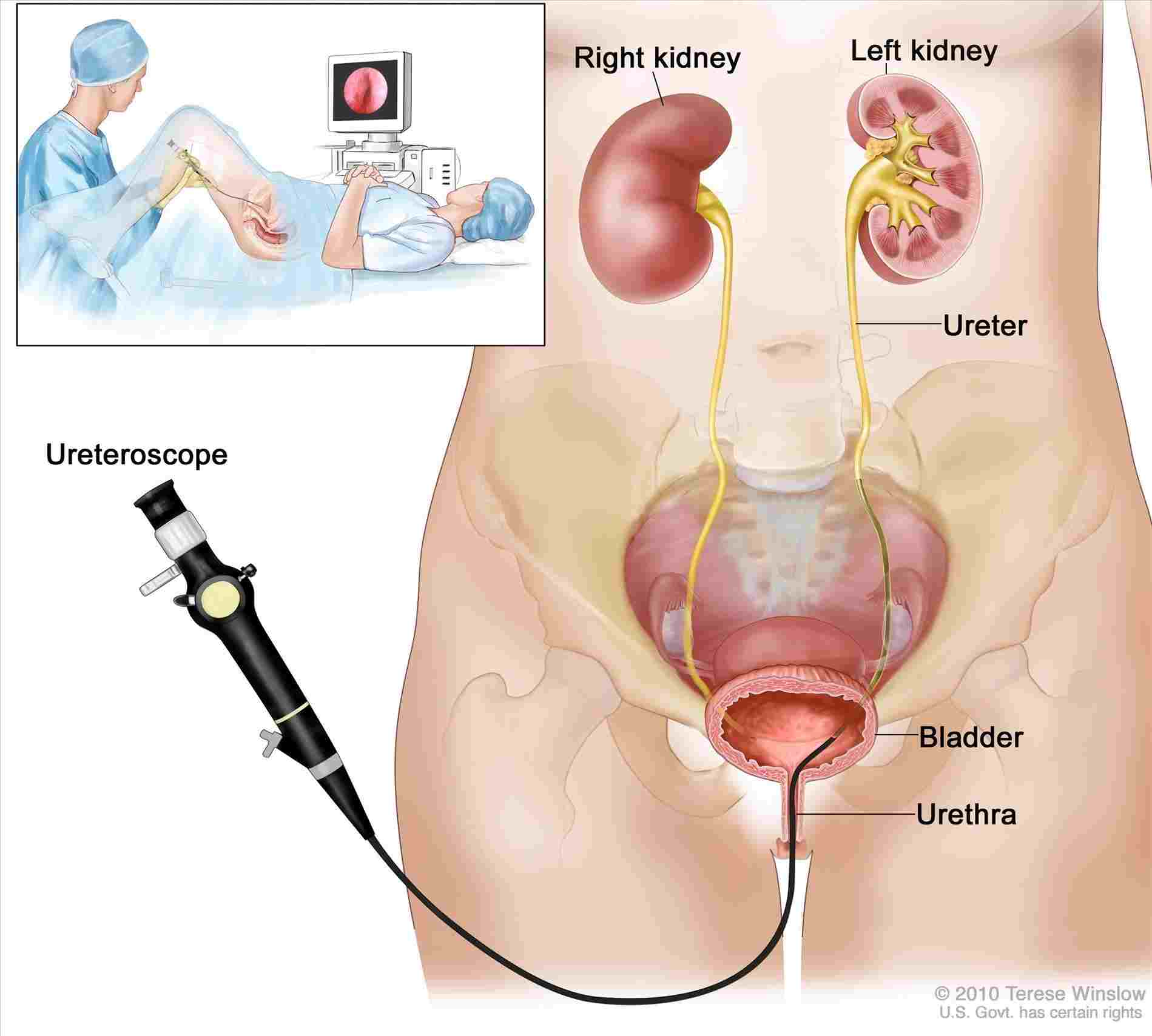 Urinary System Diagram Urinary System Diagram Male And Female Diagram Anatomy Body